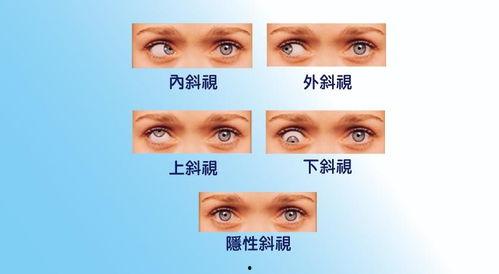 怎么调整成人斜视视频,视频教程与调整方法解析